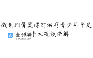 微创跗骨窦螺钉治疗青少年平足症手术视频讲解