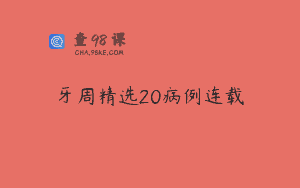 牙周精选20病例连载
